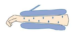 Querschnitt Ein-Kammer-System